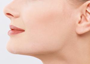 目元のたるみが気になったらアイリフト